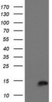 Western Blot: Cystatin C Antibody (OTI2C8)Azide and BSA Free [NBP2-70472]