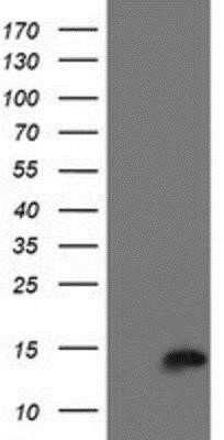 Western Blot: Cystatin C Antibody (OTI2C8) [NBP2-01875]