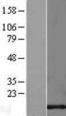 Western Blot: Cystatin C Overexpression Lysate [NBL1-09546]