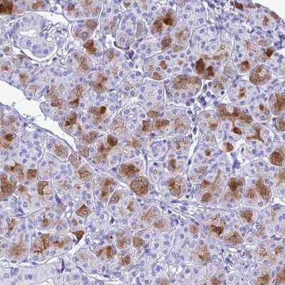 Immunohistochemistry: Cystatin D/Cst5 Antibody [NBP2-31852]