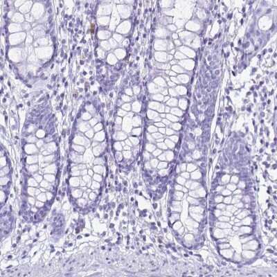 Immunohistochemistry-Paraffin: Cystatin D/Cst5 Antibody [NBP2-31852]