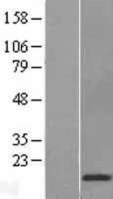 Western Blot: Cystatin D/Cst5 Overexpression Lysate [NBP2-10785]