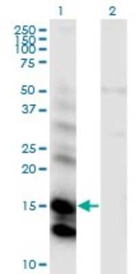 Western Blot: Cystatin E/M/CST6 Antibody (2H8) [H00001474-M01]