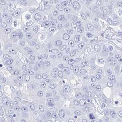 Immunohistochemistry-Paraffin: Cystatin E/M/CST6 Antibody [NBP2-33433]