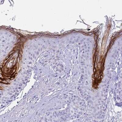 Immunohistochemistry-Paraffin: Cystatin E/M/CST6 Antibody [NBP2-33433]