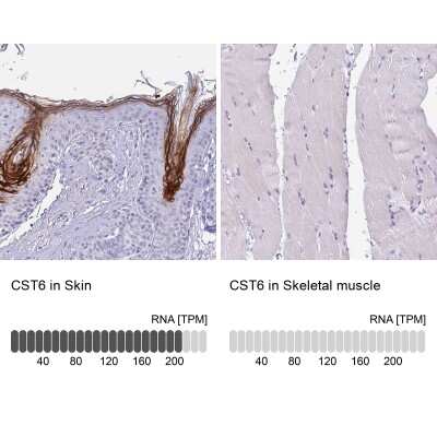 Immunohistochemistry-Paraffin: Cystatin E/M/CST6 Antibody [NBP2-33433]