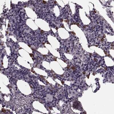 Immunohistochemistry-Paraffin: Cystatin F Antibody [NBP2-13881]