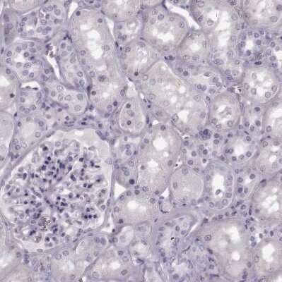 Immunohistochemistry-Paraffin: Cystatin F Antibody [NBP2-13881]