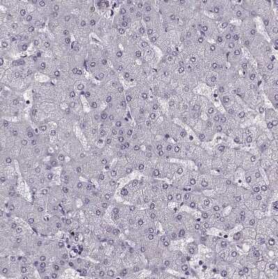Immunohistochemistry-Paraffin: Cystatin F Antibody [NBP2-13881]