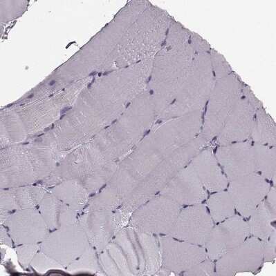 Immunohistochemistry-Paraffin: Cystatin F Antibody [NBP2-13881]