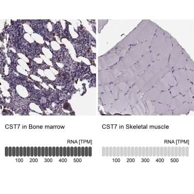 Immunohistochemistry-Paraffin: Cystatin F Antibody [NBP2-13881]