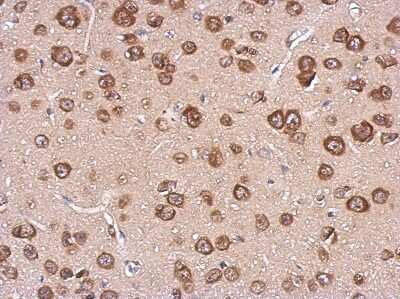 Immunohistochemistry-Paraffin: Cystatin F Antibody [NBP2-16074]