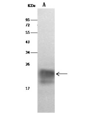 Western Blot: Cystatin F Antibody [NBP2-99007]