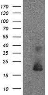 Western Blot: Cystatin S Antibody (OTI2H10) [NBP2-01656]