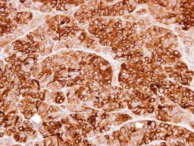 Immunohistochemistry-Paraffin: Cystatin S Antibody [NBP1-32996]