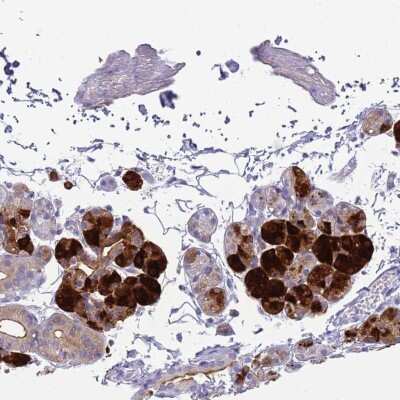 Immunohistochemistry-Paraffin: Cystatin S Antibody [NBP2-33430]