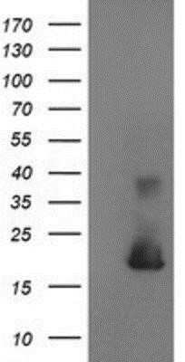 Western Blot: Cystatin S Antibody (OTI2H10)Azide and BSA Free [NBP2-70481]