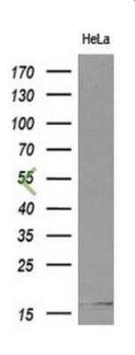 Western Blot: Cystatin S Antibody (OTI2H10) [NBP2-01656]