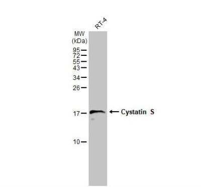 Western Blot: Cystatin S Antibody [NBP1-32996]