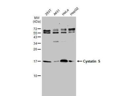 Western Blot: Cystatin S Antibody [NBP1-32996]