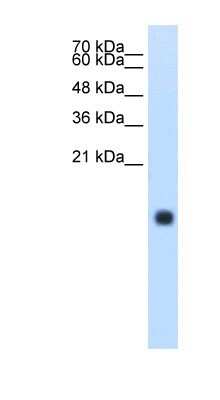 Western Blot: Cystatin S Antibody [NBP1-57919]