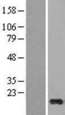 Western Blot: Cystatin S Overexpression Lysate [NBL1-09547]