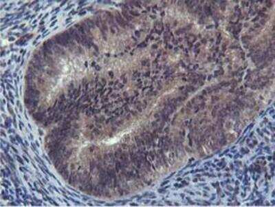 Immunohistochemistry-Paraffin: Cystatin SA Antibody (OTI1D6) [NBP2-01747]