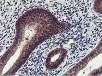 Immunohistochemistry-Paraffin: Cystatin SA Antibody (OTI1D6) [NBP2-01747]