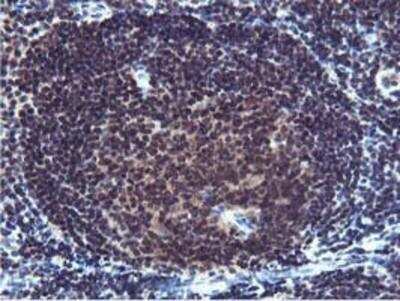 Immunohistochemistry-Paraffin: Cystatin SA Antibody (OTI1D6) [NBP2-01747]