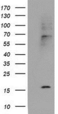 Western Blot: Cystatin SA Antibody (OTI1D6) [NBP2-01747]