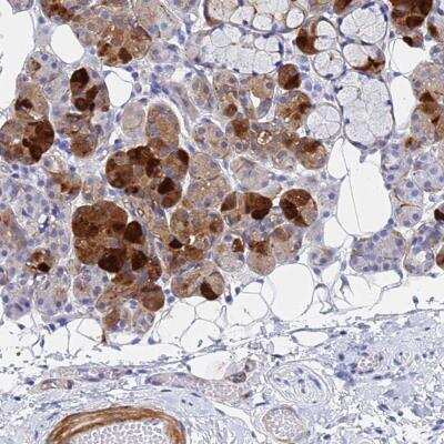 Immunohistochemistry: Cystatin SA Antibody [NBP2-33401]