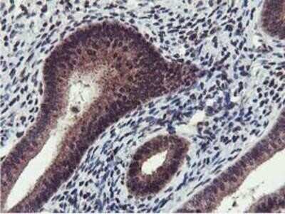 Immunohistochemistry: Cystatin SA Antibody (OTI1D6) - Azide and BSA Free [NBP2-70466]