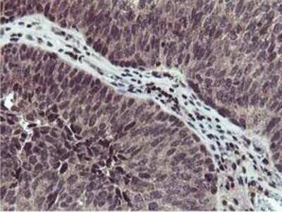Immunohistochemistry: Cystatin SA Antibody (OTI1D6) - Azide and BSA Free [NBP2-70466]