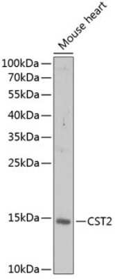 Western Blot: Cystatin SA AntibodyBSA Free [NBP2-92665]