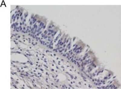 Immunohistochemistry: Cystatin SN Antibody [H00001469-B01P]