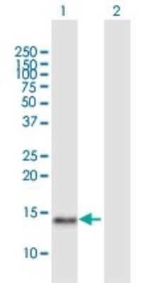 Western Blot: Cystatin SN Antibody [H00001469-B01P]