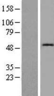 Western Blot: Cystatin SN Overexpression Lysate [NBP2-10786]