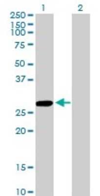 Western Blot: Cysteine Conjugate beta-Lyase/CCBL1 Antibody (1B12) [H00000883-M02]