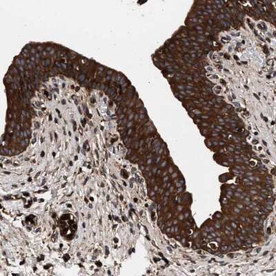 Immunohistochemistry-Paraffin: Cysteine Conjugate beta-Lyase/CCBL1 Antibody [NBP1-83316]