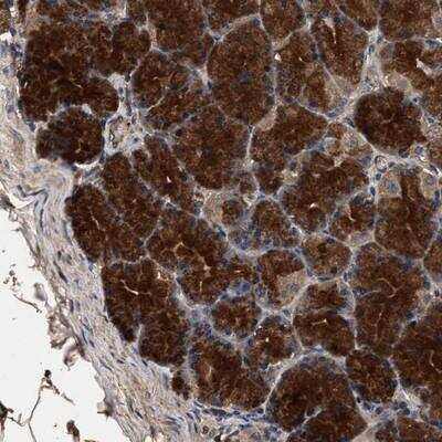 Immunohistochemistry-Paraffin: Cysteine Conjugate beta-Lyase/CCBL1 Antibody [NBP1-83317]