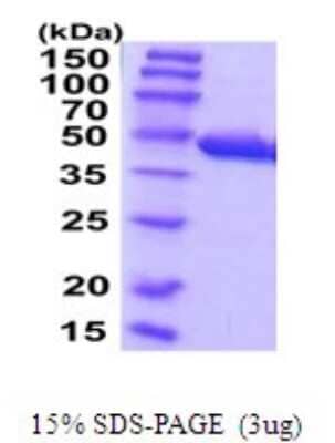 SDS-PAGE: Recombinant Human Cysteine Conjugate beta-Lyase/CCBL1 His Protein [NBP2-52105]