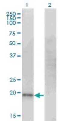 Western Blot: Cysteine Dioxygenase Type 1 Antibody (4B4) [H00001036-M09]