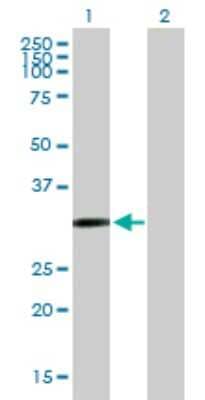 Western Blot: Cysteine Dioxygenase Type 1 Antibody [H00001036-B01P]