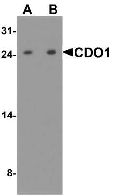 Western Blot: Cysteine Dioxygenase Type 1 AntibodyBSA Free [NBP2-82081]