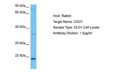 Western Blot: Cysteine Dioxygenase Type 1 Antibody [NBP2-87241]