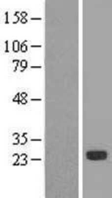 Western Blot: Cysteine Dioxygenase Type 1 Overexpression Lysate [NBL1-09058]