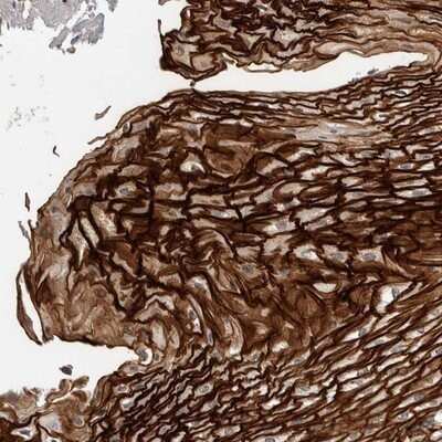 Immunohistochemistry-Paraffin: Cysteine Rich Tail 1 Antibody [NBP1-81057]