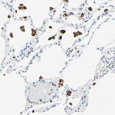Immunohistochemistry-Paraffin: Cysteinyl Leukotriene R1/CysLTR1 Antibody [NBP1-85356]