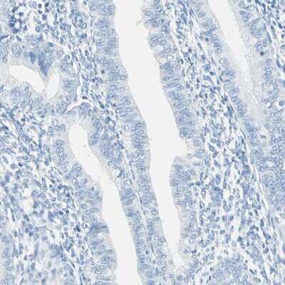 Immunohistochemistry-Paraffin: Cysteinyl Leukotriene R1/CysLTR1 Antibody [NBP1-85356]
