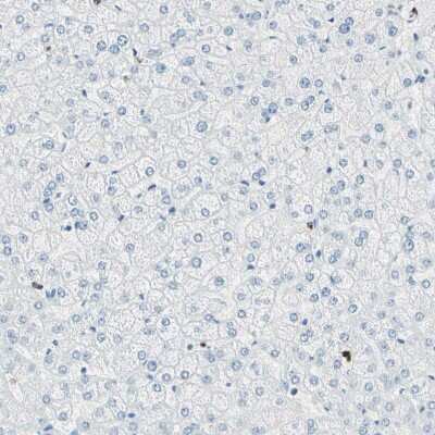 Immunohistochemistry-Paraffin: Cysteinyl Leukotriene R1/CysLTR1 Antibody [NBP1-85356]